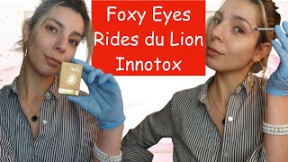 Foxy Eyes et traitement rides du Lion avec Innotox Botox a la maison a moindre cout [upl. by Selin]