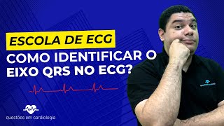 Como identificar o eixo QRS no ECG [upl. by Strickler912]