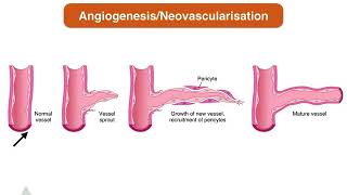 Mechanisms of scar formation [upl. by Survance684]