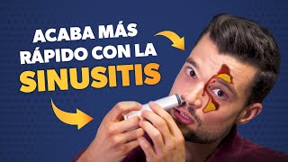 Cómo curar la SINUSITIS más rápido [upl. by Eustacia662]