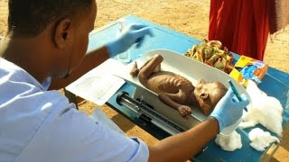 Malnutrition at record high in droughthit Somalia ICRC [upl. by Aikit690]