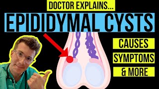 Doctor explains TESTICULAR LUMPS PART 1  EPIDIDYMAL CYSTS causes symptoms and treatments [upl. by Noval214]