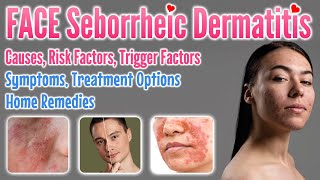 Seborrheic Dermatitis Face Causes Risk amp Trigger Factors Symptoms Treatment Options Home Remedies [upl. by Otreblig]