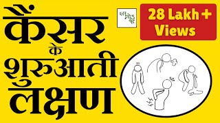 Common cancer signs Hindi Cancer Ke Shuruati Lakshan  Cancer early signs hindi [upl. by Gretchen]