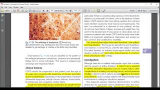 COPD  Respiratory Medicine  UrduHindi  Davidson Medicine [upl. by Oribel]