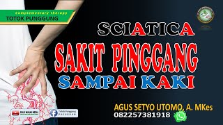 SAKIT PINGGANG SAMPAI KAKI SCIATICA ATASI DENGAN TOTOK PUNGGUNG [upl. by Jacobah]