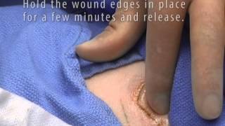 dermaflex® QS™ Trauma Wound Application [upl. by Rosio83]