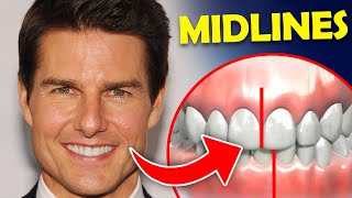 Why Tom Cruises teeth look off  how to fix a midline [upl. by Akeemat]