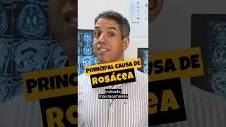 PRINCIPAL CAUSA DE ROSÁCEA  Dr Alain Dutra shorts rosacea [upl. by Yniatirb]