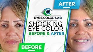 Shocking Eye Color Before and After  Eyes Color Lab [upl. by Aneras]