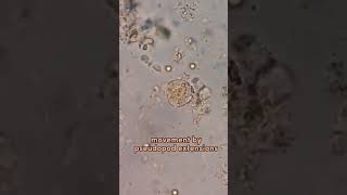 entamoeba histolytica locomotion pseudopodia amazing [upl. by Dot]