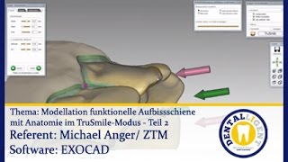 Dentaltechnik CADCAMTeaser  Model funkt Aufbißschiene mit Anatomie im TruSmileModus  Teil 2 [upl. by Corty]