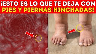 Tratamiento INFALIBLE para EXTERMINAR LA HINCHACIÓN en los PIES DE UNA VEZ POR TODAS [upl. by Aerdnas]