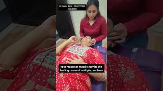 Masseter treatment with dry needling 💥 masseter trending viralvideo ytshorts [upl. by Emelita]