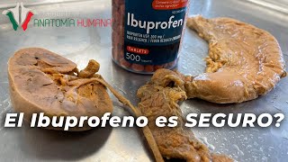 Lo que el IBUPROFENO le hace a TU CUERPO [upl. by Happy]