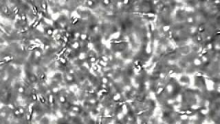 Semen sperm cells under the microscope at 400x [upl. by Legir708]