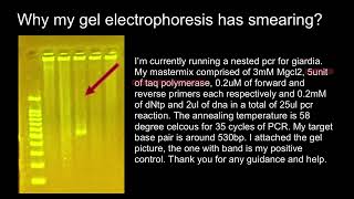 What taq polymerase 1 unit means [upl. by Oirogerg]