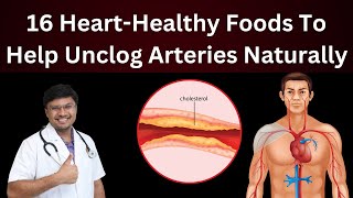 quotClean Arteries Naturally Top Foods to Unclog Your Coronary Arteries 🍏 Must Watch [upl. by Ecitsuj]