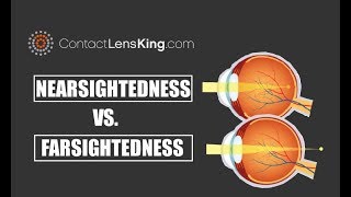 Nearsightedness Vs Farsightedness and the Difference Between the Two [upl. by Idoux]