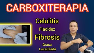 Carboxiterapia  Celulitis flacidez fibrosis Grasa Localizada  Aplicación [upl. by Sefton]