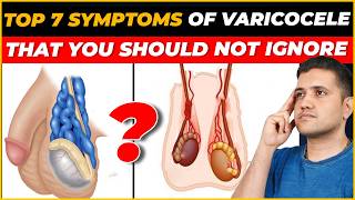 Top 7 Symptoms of Varicocele You Shouldn’t Ignore  Best Treatment Explained by Dr Gaurav Gangwani [upl. by Nayra745]