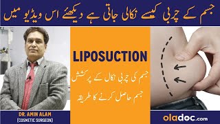 Liposuction Procedure  How To Get Tummy Tuck  Fast Fat Loss  Liposuction Before And After Results [upl. by Benedikta]