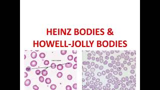 HEINZ BODIES and HOWELLJOLLY BODIES [upl. by Anek]