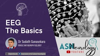 EEG  The Basics by Dr Sudath Gunasekera [upl. by Christen414]