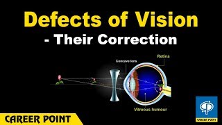 Defects of Vision and Their Correction Myopia And Hypermetropia [upl. by Kuehn]