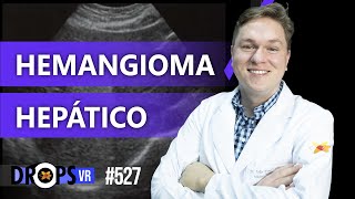 COMO RECONHECER HEMANGIOMA HEPÁTICO NA ULTRASSONOGRAFIA  VOCÊ RADIOLOGISTA [upl. by Crichton]