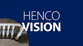 How to use Henco vision [upl. by Yleve]