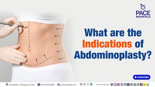 Abdominoplasty Indications  What are the Indications of Abdominoplasty  Abdominoplasty [upl. by Hilaria506]