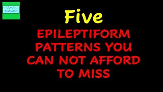 FIVE EPILEPTIFORM PATTERNS THAT YOU SHOULD NEVER MISS [upl. by Ermina]