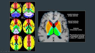 MEDIMAG  Neuroradiología [upl. by Nancy]