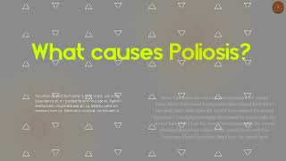 What causes Poliosis Is Poliosis a disease [upl. by Eadith843]