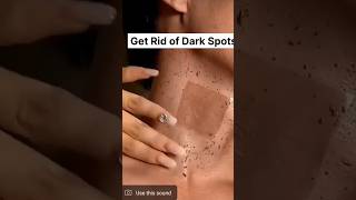 Neck cleaning Tips  Dark Neck Home Remedies Tanning Removal Tips😱 suntan ytshorts beauty skin [upl. by Ahsille]