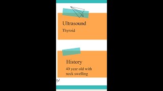 Thyroid ultrasound  SpotTheDiagnosis [upl. by Taam817]