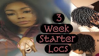 Retwisting My 3 Week Starter LocsCoils on 3b3c Hair 🙈🥰👀 [upl. by Payne]