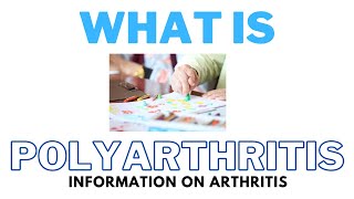 What Is Polyarthritis  The Cause The Symptoms amp The Diagnosis [upl. by Roxana]