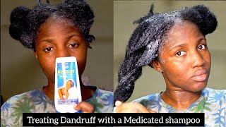 How to apply medicated antidandruff shampoo with ketoconazole on Natural Hair [upl. by Eelamme834]