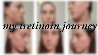 8 MONTH TRETINOIN JOURNEY UNSPONSORED APOSTROPHE REVIEW [upl. by Nikoletta]