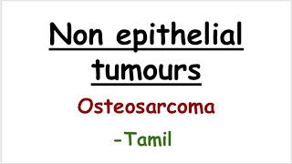 Osteosarcomaoral pathology tamil [upl. by Irrehs197]