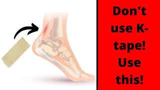 Taping for Achilles Tendonitis  two techniques you wont find anywhere else [upl. by Vincenta751]