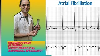 ATRIAL FIBRALATION BY DRSUMIT TYAGISUMITMEDICALDISPENSARY1 [upl. by Ahsinawt]