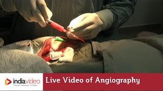 Live Video of Angiography at Lisie Hospital  How angiography is done [upl. by Incrocci]