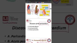 pericardial diseases and myocarditis [upl. by Hajin759]