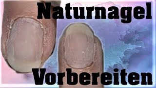 Nagelhaut entfernen  Tipps amp Tricks für Anfänger Gelnägel selber machen Teil 1 [upl. by Assira220]