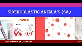 Lecture 17 Sideroblastic Anemia  SA [upl. by Durston]