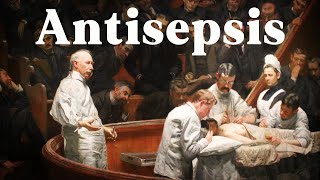 How Joseph Lister Changed Surgery Forever Invention of Antiseptic Surgery [upl. by Coppola801]