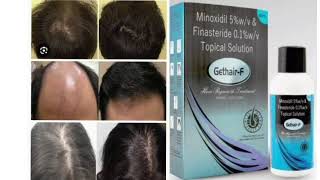 Gethair F Topical Solution Minoxidil 5wv amp Finasteride 01wv Topical Solution [upl. by Gnav636]